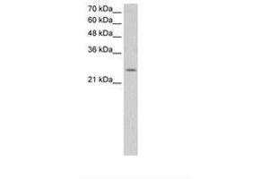 Image no. 2 for anti-Fatty Acid Hydroxylase Domain Containing 2 (FAXDC2) (N-Term) antibody (ABIN6736644) (C5ORF4 anticorps  (N-Term))
