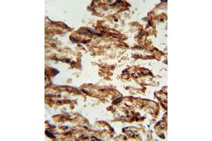 Immunohistochemistry (IHC) image for anti-Insulin-Like Growth Factor Binding Protein 4 (IGFBP4) antibody (ABIN3002898) (IGFBP4 anticorps)