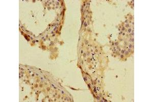 Immunohistochemistry of paraffin-embedded human testis tissue using ABIN7163844 at dilution of 1:100 (PHC1 anticorps  (AA 142-225))