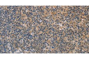 Immunohistochemistry of paraffin-embedded Human tonsil using FXYD1 Polyclonal Antibody at dilution of 1:60 (FXYD1 anticorps)