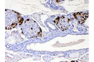 IHC analysis of RBP4 using anti-RBP4 antibody .