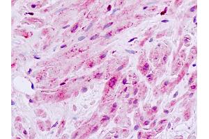 Human, Prostate, smooth muscle: Formalin-Fixed Paraffin-Embedded (FFPE) (MAP3K9 anticorps  (Internal Region))