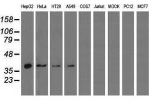 Western blot analysis of extracts (35 µg) from 9 different cell lines by using anti-HIBCH monoclonal antibody. (HIBCH anticorps)