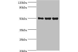 Western blot All lanes: TERF1 antibody at 2 μg/mL Lane 1: k562 whole cell lysate Lane 2: 293T whole cell lysate Lane 3: Jurkat whole cell lysate Secondary Goat polyclonal to rabbit IgG at 1/10000 dilution Predicted band size: 51, 49 kDa Observed band size: 51 kDa (TRF1 anticorps  (AA 260-439))