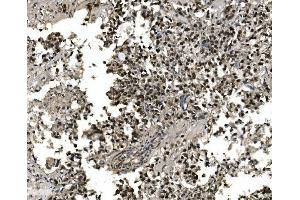 IHC analysis of FOXA2 using anti-FOXA2 antibody (ABIN7600003). (FOXA2 anticorps  (AA 139-446))