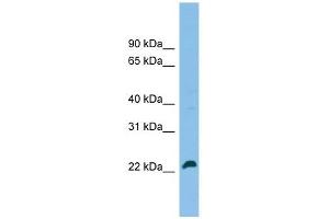 SPATA24 antibody used at 1 ug/ml to detect target protein. (SPATA24 anticorps  (C-Term))