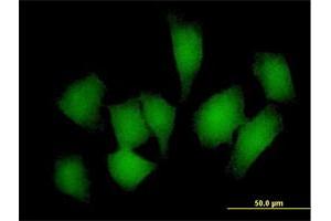 Immunofluorescence of purified MaxPab antibody to REM1 on HeLa cell. (REM1 anticorps  (AA 1-298))