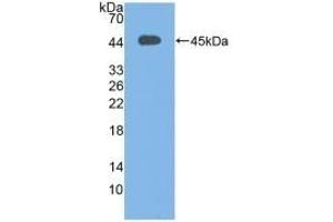 Detection of Recombinant C3c, Human using Polyclonal Antibody to Complement C3 Convertase (C3 Convertase) (Complement C3 Convertase anticorps)