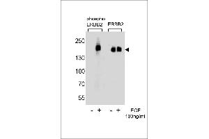 Western blot analysis of extracts from A431 cells,untreated or treated with EGF,100 ng/mL ,using phospho ERBB2-(left) or ERBB2 Antibody (right) (ErbB2/Her2 anticorps  (pTyr1127))