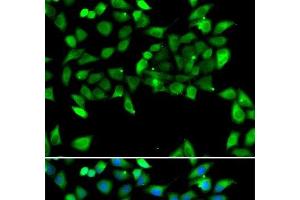 Immunofluorescence analysis of U2OS cells using EIF3H Polyclonal Antibody (EIF3H anticorps)