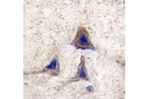 IHC analysis of FFPE human brain tissue stained with BRAF antibody