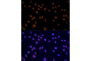 Immunofluorescence analysis of C6 using SMC3 antibody (ABIN7270616) at dilution of 1:100. (SMC3 anticorps)