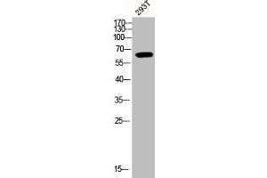 Western Blot analysis of 293T cells using Phospho-Akt1 (Y474) Polyclonal Antibody (AKT1 anticorps  (pTyr474))