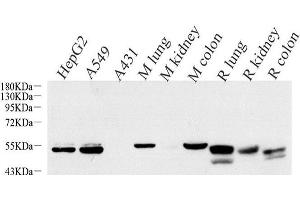 Western Blot analysis of various samples using CK-7 Monoclonal Antibody at dilution of 1:1000. (Cytokeratin 7 anticorps)