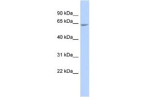 WB Suggested Anti-GALNTL4 Antibody Titration:  0. (UDP-N-Acetyl-alpha-D-Galactosamine:polypeptide N-Acetylgalactosaminyltransferase 18 (GALNT18) (Middle Region) anticorps)