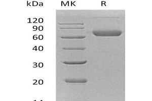 Western Blotting (WB) image for Ephrin B2 (EFNB2) protein (His tag,Fc Tag) (ABIN7320517)