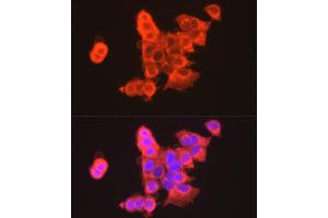 Immunofluorescence analysis of MCF7 cells using CLDN3 antibody (ABIN3017039, ABIN3017040, ABIN3017041, ABIN1679261 and ABIN6219930) at dilution of 1:100. (Claudin 3 anticorps)