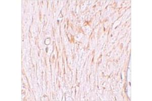 Immunohistochemistry of ZBTB7A in Human ovary tissue with ZBTB7A / Pokemon antibody at 2.