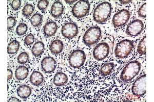 Immunohistochemistry (IHC) analysis of paraffin-embedded Human uterus, antibody was diluted at 1:100.