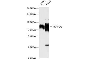 Western blot analysis of extracts of various cell lines, using TR antibody (ABIN6132266, ABIN6149468, ABIN6149469 and ABIN6216926) at 1:1000 dilution. (TRAFD1 anticorps  (AA 1-260))