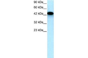 WB Suggested Anti-EYA3 Antibody Titration:  0. (EYA3 anticorps  (Middle Region))