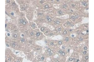 Detection of AK2 in Rat Liver Tissue using Polyclonal Antibody to Adenylate Kinase 2 (AK2)