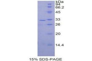SDS-PAGE (SDS) image for Mitogen-Activated Protein Kinase 9 (MAPK9) (AA 130-387) protein (His tag) (ABIN1878430)