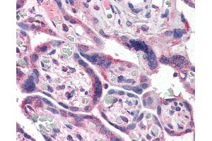Anti-NFKB1 antibody IHC of human placenta.