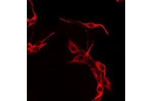 ABIN6275666 staining HepG2 by IF/ICC.