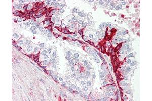 Anti-GPR55 antibody IHC staining of human prostate. (GPR55 anticorps  (C-Term))