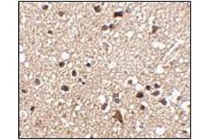 anti-Junctophilin 3 (JPH3) (C-Term) antibody