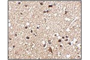 Immunohistochemistry of JPH3 in human brain tissue with this product at 2.
