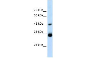 WB Suggested Anti-HOXC9 Antibody Titration:  2. (HOXC9 anticorps  (Middle Region))