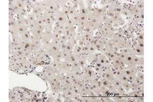 Immunoperoxidase of monoclonal antibody to PRKDC on formalin-fixed paraffin-embedded human liver.