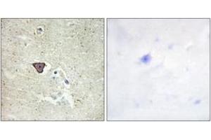 Immunohistochemistry analysis of paraffin-embedded human brain tissue, using CDH9 Antibody.