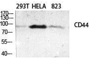 Western Blot (WB) analysis of specific cells using CD44 Polyclonal Antibody.