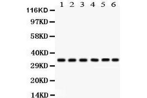 Western Blotting (WB) image for anti-Cyclin-Dependent Kinase 1 (CDK1) (AA 66-297) antibody (ABIN3043473) (CDK1 anticorps  (AA 66-297))