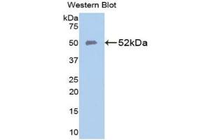 Detection of Recombinant FPN, Human using Polyclonal Antibody to Ferroportin (FPN) (SLC40A1 anticorps  (AA 127-321))