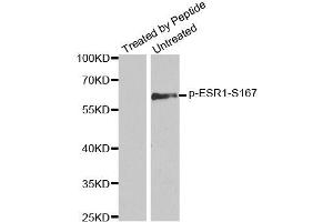 Western blot analysis of extracts from MCF7 cells using Phospho-ESR1-S167 antibody (ABIN2988007). (Estrogen Receptor alpha anticorps  (pSer167))