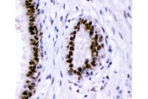 IHC analysis of p95 NBS1 using anti-p95 NBS1 antibody (ABIN3043282). (Nibrin anticorps  (C-Term))