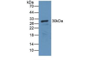 Detection of Recombinant CA2, Canine using Polyclonal Antibody to Carbonic Anhydrase II (CA2) (CA2 anticorps)