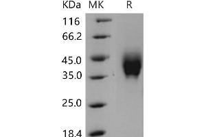 Western Blotting (WB) image for Interferon gamma Receptor 2 (Interferon gamma Transducer 1) (IFNGR2) protein (His tag) (ABIN7320197)