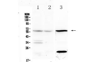 Western blot analysis of IL23 Receptor using anti-IL23 Receptor antibody .