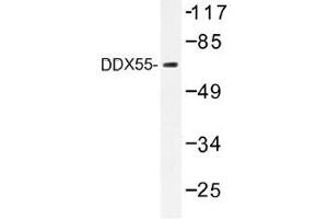 Image no. 1 for anti-DEAD (Asp-Glu-Ala-Asp) Box Polypeptide 55 (DDX55) antibody (ABIN317819)