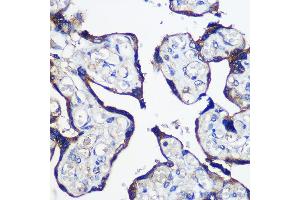 Immunohistochemistry of paraffin-embedded Human placenta using P Rabbit pAb (ABIN6133216, ABIN6145242, ABIN6145243 and ABIN6216694) at dilution of 1:100 (40x lens). (PARP8 anticorps  (AA 1-300))