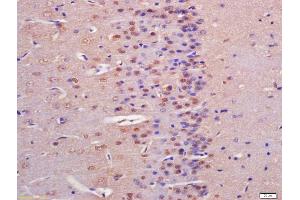 Formalin-fixed and paraffin embedded rat brain labeled with Anti-IGFBP9 Polyclonal Antibody, Unconjugated (ABIN761816) at 1:200 followed by conjugation to the secondary antibody and DAB staining