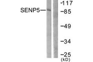 Western blot analysis of extracts from COS7 cells, using SENP5 Antibody. (SENP5 anticorps  (AA 651-700))