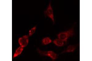 ABIN6274802 staining Hela cells by IF/ICC. (ACTR3 anticorps  (C-Term))