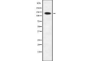 Western blot analysis Sin3B using A549 whole cell lysates (SIN3B anticorps  (Internal Region))