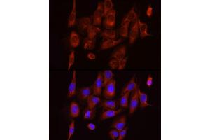 Immunofluorescence analysis of U2OS cells using S6 Ribosomal Protein (RPS6) Rabbit mAb (ABIN7270026) at dilution of 1:100 (40x lens). (RPS6 anticorps)